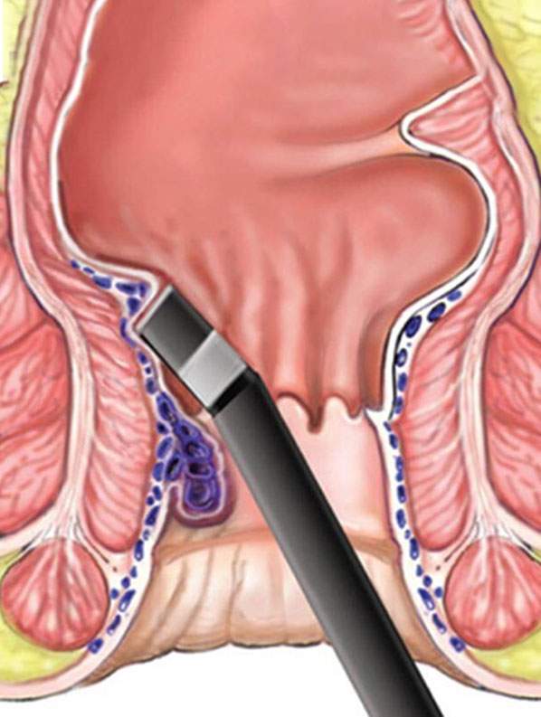 Modern Medical Treatment